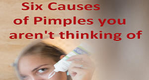 Six Causes of Pimples you aren’t thinking of.